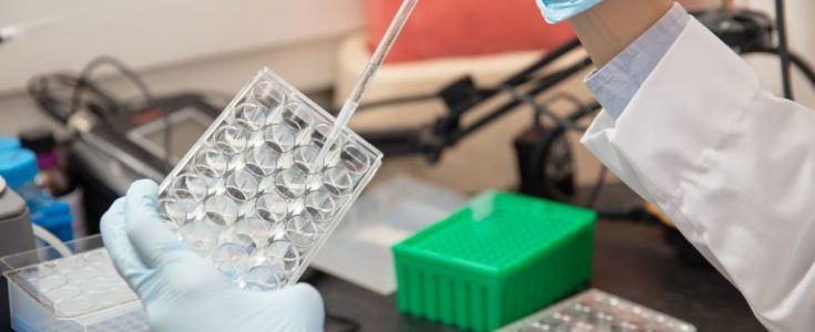 Medical professional using a pipette on a set of vials