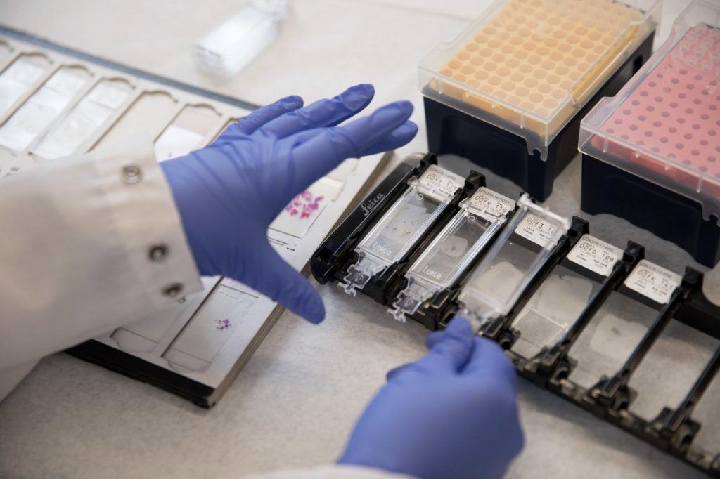 Gloved hands lifting up a microscope slide