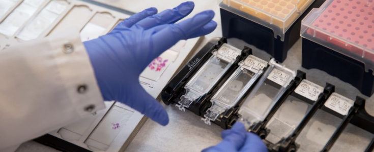 Researcher handling lab slides