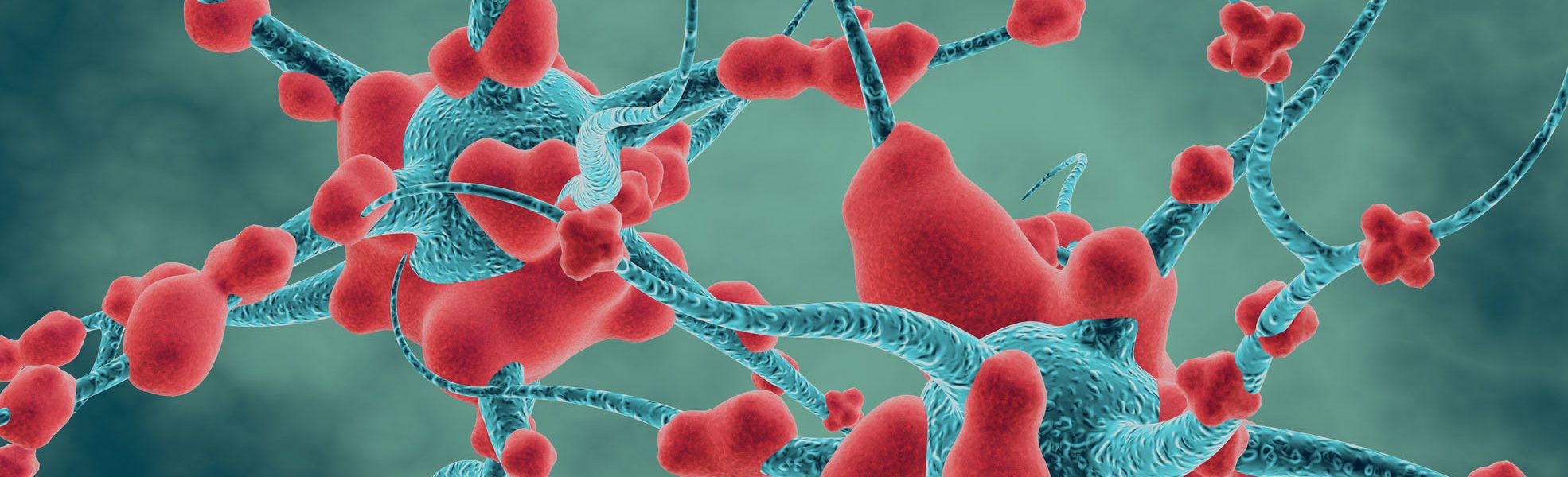 Neurodegenerative disease, neural system and memory problems concept 3d render