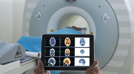Glioblastoma Clinical Trials