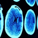 Brain imaging on screen