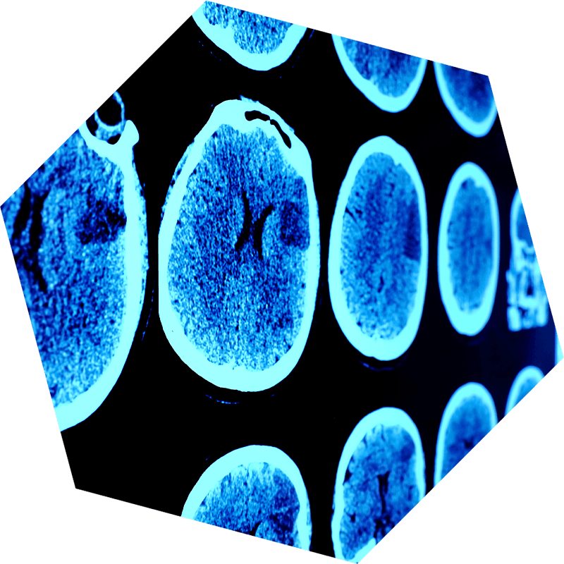 brain imaging