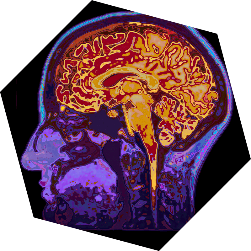 Brain imaging