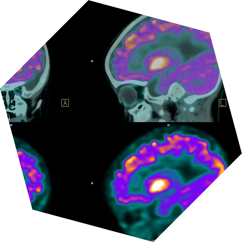brain imaging