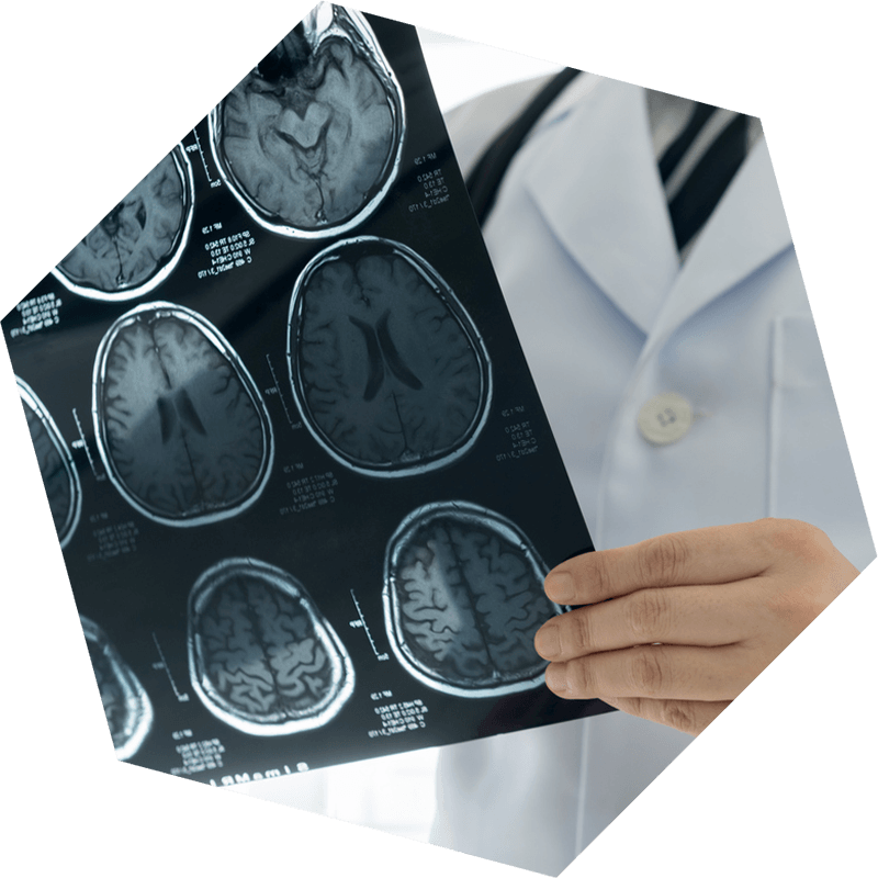 brain x ray imaging in hand