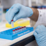 Researcher in pharmacokinetics lab analyzes brain tumor tissue to measure drug concentrations
