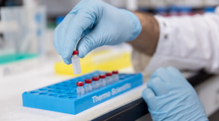 Researcher in pharmacokinetics lab analyzes brain tumor tissue to measure drug concentrations